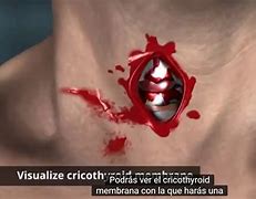 Image result for f�crico