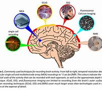 Image result for Brain Activity