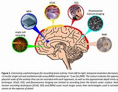 Image result for Brain Neuron Activity