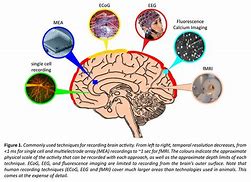 Image result for Normal Brain Activity