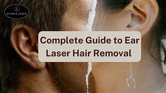 Image result for Laser Ear Hair Removal