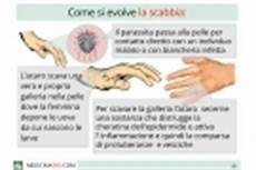 psoriasi alimentazione consigliata eruzioni cutanee psoriasi alimentazione consigliata eruzioni cutanee