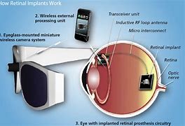 Image result for Human Augmentation Technology with Retina Display