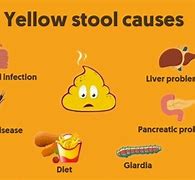 Image result for Yellow Liqud Stool