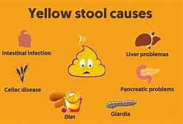 Image result for Yellow Watery Stool