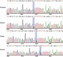 Image result for Homozygous Sequence