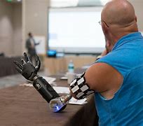 Image result for High-Tech Prosthetic Arm
