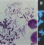 Image result for Chromosome Condensation