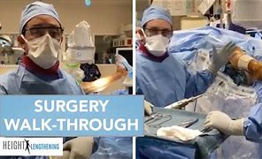 Image result for Height Increasing Surgery Upper Torso