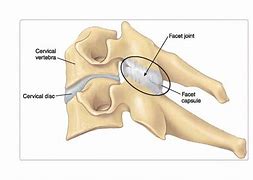 Image result for Facet Joint Capsule