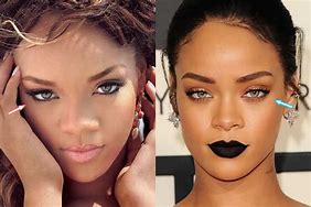 Image result for Rihanna Lip Injections