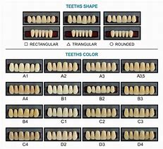 Image result for Affordable Dentures and Implants Denture Color Chart