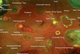 Image result for retinal displays benefit