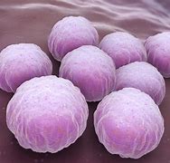 Image result for Granuloma Venereum