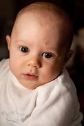 Image result for Baby Big Head Syndrome