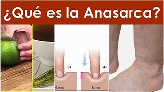 Image result for aneciarse
