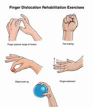 Image result for Dislocated Finger Exercises