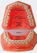 Image result for Tooth Diagram