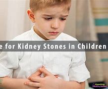 Image result for Alcohol and Kidney Stones