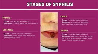 Image result for Syphilis Infant