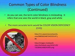 Image result for All Types of Color Blindness
