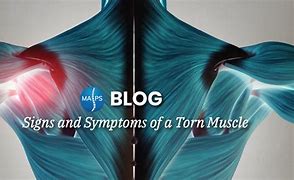 Image result for Muscle Torn Marks