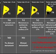 Image result for Cancer Stages Chart