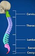 Image result for Lumbar Spine Nerve Roots Anatomy