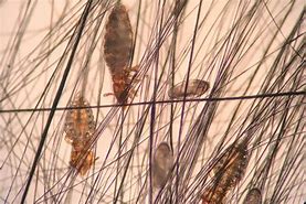 Image result for Chewing Lice On Humans
