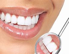 Image result for dental