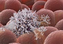 Image result for Cancer Stem Cell Model