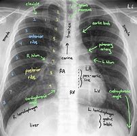 Image result for Radiography Number Organizer
