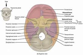 Image result for Occipital Cyst