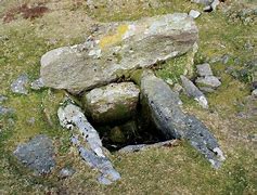 Image result for Gambar Cist