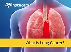 Image result for Black Tar in Lungs