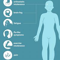 Image result for chronic fatigue
