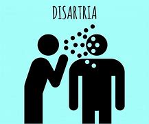 Image result for disartria