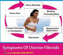 Image result for Symptoms of a Uterine Fibroid