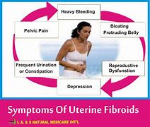 Image result for Uterine Fibroid Enlarged Uterus