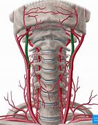 Image result for Carotid Artery Neck