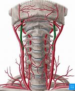 Image result for What Is a Carotid