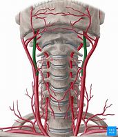 Image result for Segments Internal Carotid Artery Anatomy
