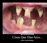 Image result for acucioso
