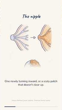 Why you need to check your skin for these breast cancer signs ‼️ #breastcancer #health #awareness