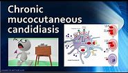 Chronic mucocutaneous candidiasis - Immunology USMLE Step 1