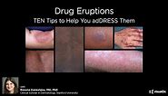 Drug Eruptions: TEN tips to help you adDRESS them