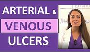 Arterial Ulcers vs. Venous Ulcers Nursing (Characteristics) for PVD (Peripheral Vascular Disease)