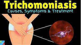 Trichomoniasis: Causes, Symptoms, Diagnosis, Treatments and prevention