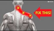 How to INSTANTLY Fix Pinched Nerve Pain in the Neck and Shoulders