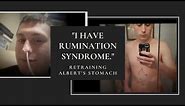 "I Have Rumination Syndrome" | Retraining Albert's Stomach